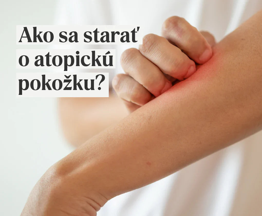 Atopický ekzém – ako súvisí s mikrobiotou a ako ho liečiť?