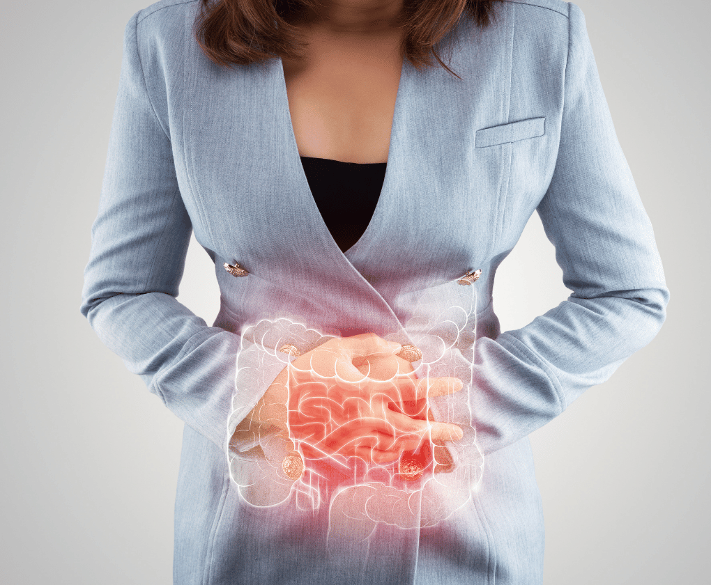 Syndróm dráždivého čreva (IBS) a funkčná medicína