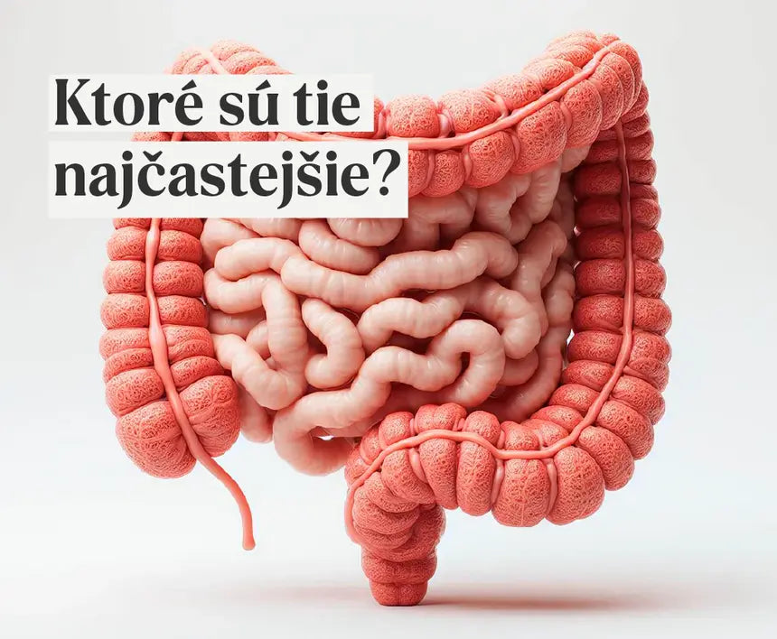 Príznaky chorých čriev: Týchto 7 je najčastejších