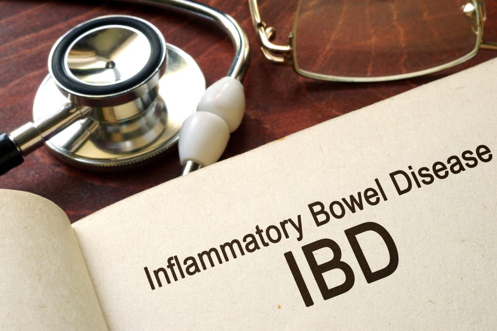 Gastroenterológ o IBD ochoreniach: Crohnova choroba a ulcerózna kolitída